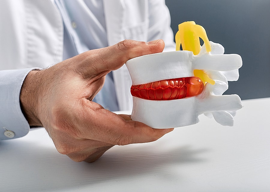 Hand holding a spinal model with highlighted details.