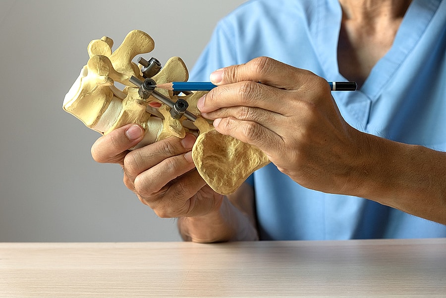 spine surgeon looking at spine model