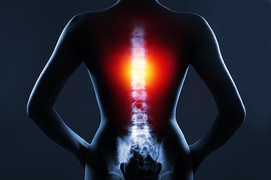 X-ray image highlighting spinal pain area.