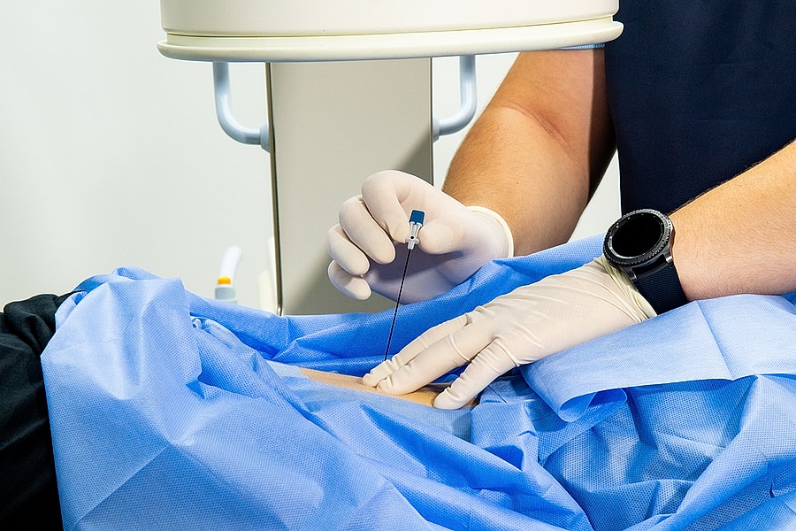 Spine Surgery Recovery: Tips for a Successful Post-Op Experience